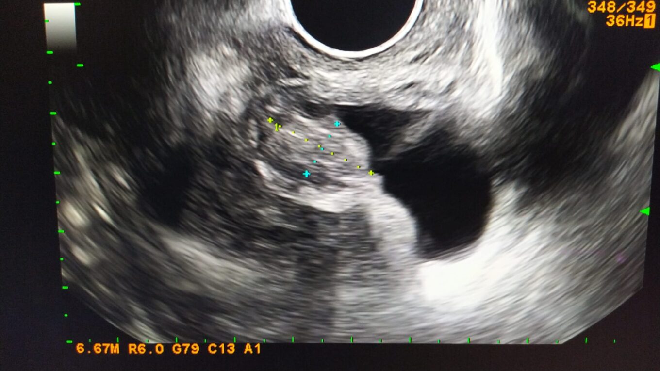 Joe Scarborough’s Unflinching Health Journey: How a Silent Diagnosis Transformed a Public Figure’s Life